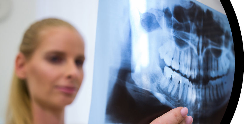 Dentista profesional sosteniendo radiografía dental