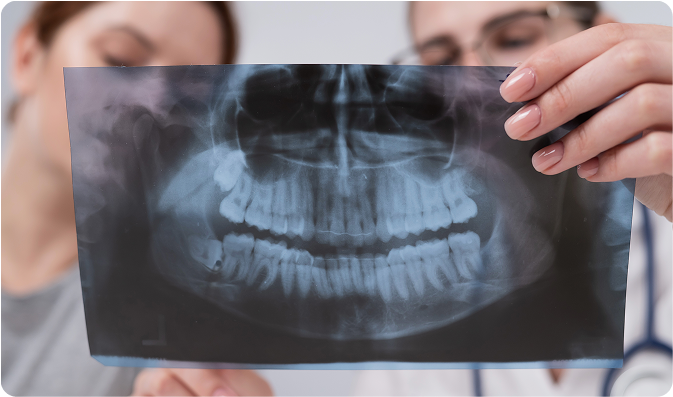 Profesionales dentales examinando radiografía